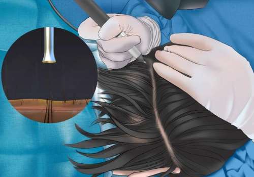 常州植发专家排名top10强测评